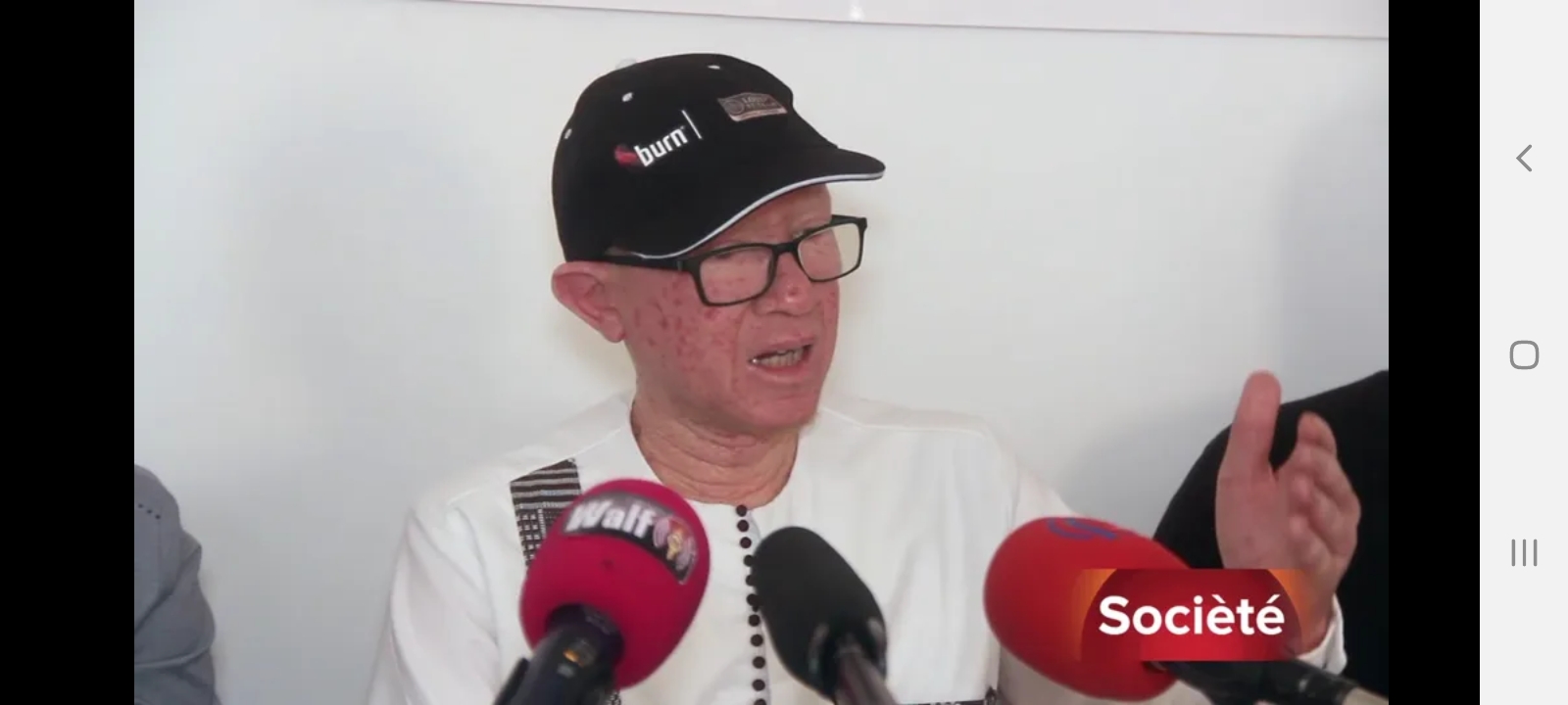 Thiès  – L’ANAS s’insurge contre la discrimination des albinos