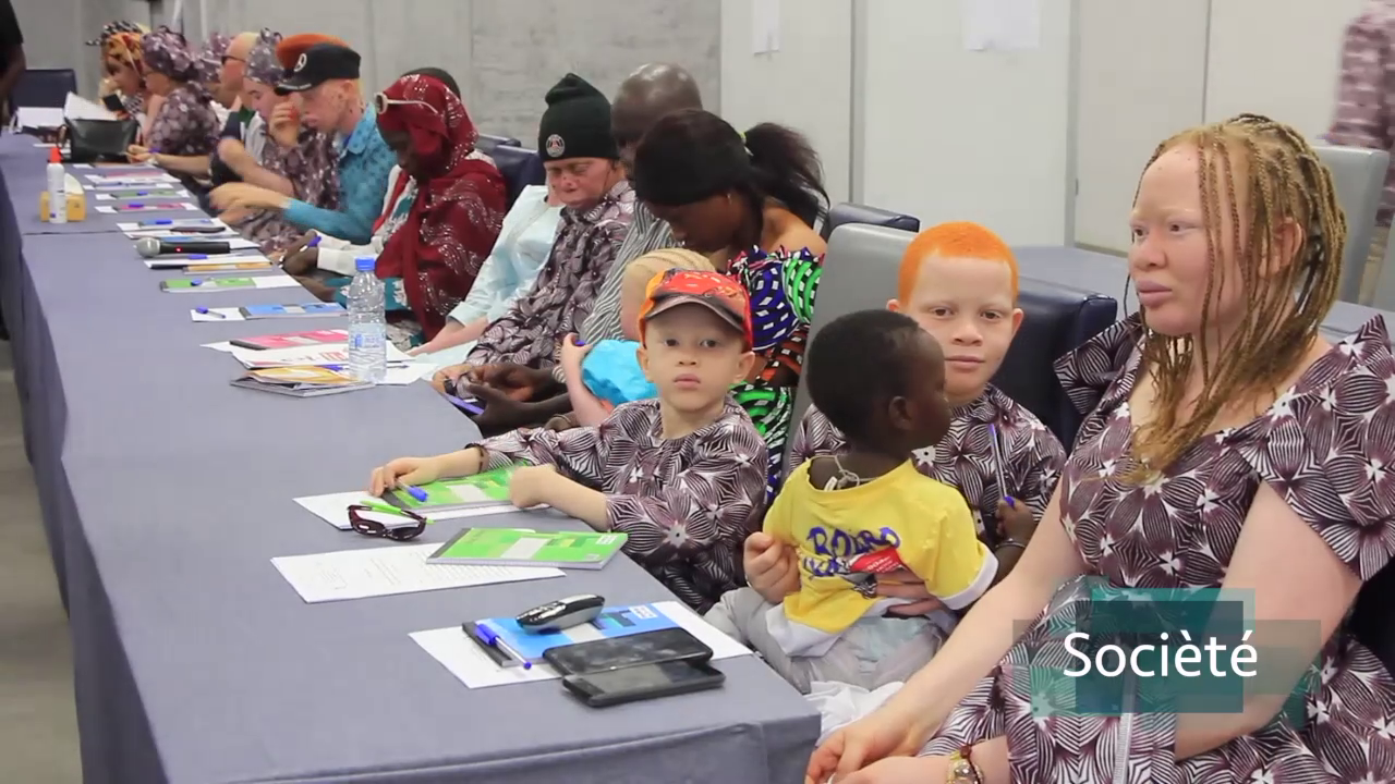 Thiès – Célébration de la Journée mondiale des Albinos par l’ANAS