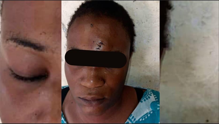 Tivaouane : Un mari bat sa femme et lui inflige de graves blessures au visage