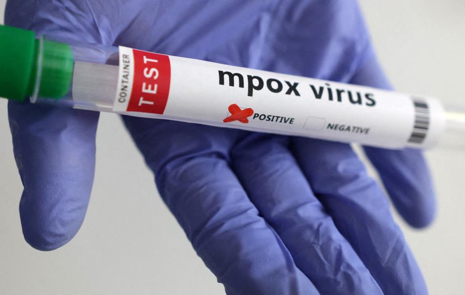 Santé – Un deuxième cas de MPOX confirmé à Dakar